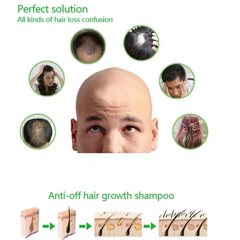 Полезный шампунь против выпадения волос улучшает качество волос натуральный травяной экстракт шампунь