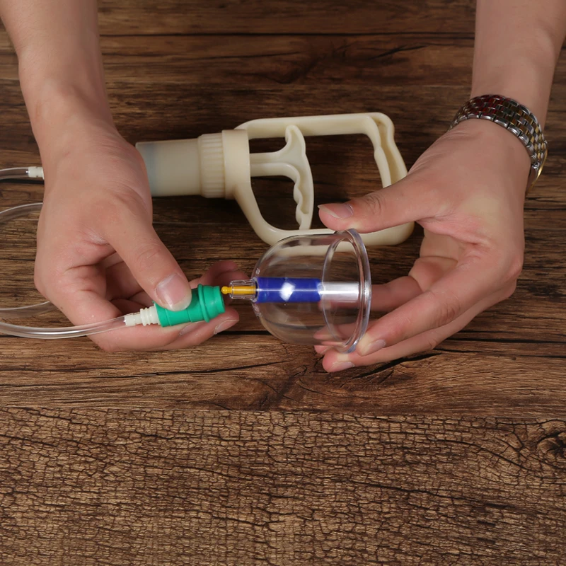 vacuum cupping (7)