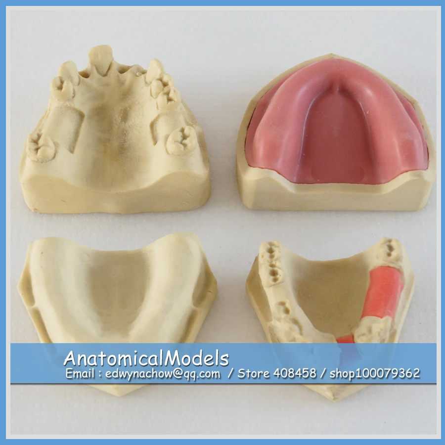 

13228 DH2007 Implant Practice Model 4pcs, Medical Science Educational Dental Teaching Models