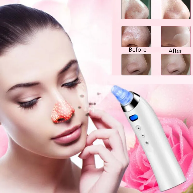 

Pore Vacuum Black Dots Tool Remover Blackhead Acne Point Noir Pore Cleaner Facial Skin Care Face Beauty Machine puntos negros