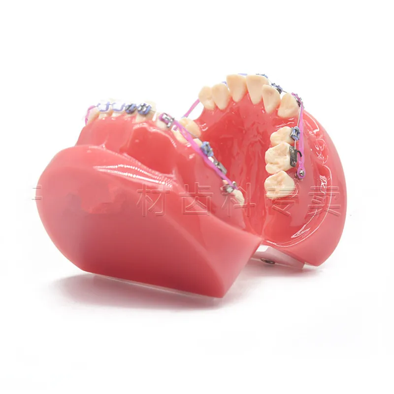 Новая модель для стоматологического ортодонтического лечения, модель с керамическими кронштейнами, цепная проволока для обучения медицине, новинка