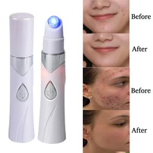 Новая лазерная ручка для акне, портативная машинка для удаления морщин, синий светильник, массажер для лица, удаление морщин, удаление акне, зарядка через USB