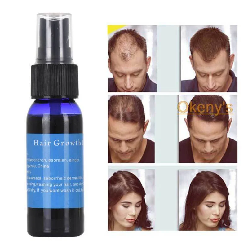 

Hair Growth Products for Men and Woman Hair Growth Essence Grow Restoration 30ml Okeny's Yuda Pilatory Stop Hair Loss Fast TSLM1
