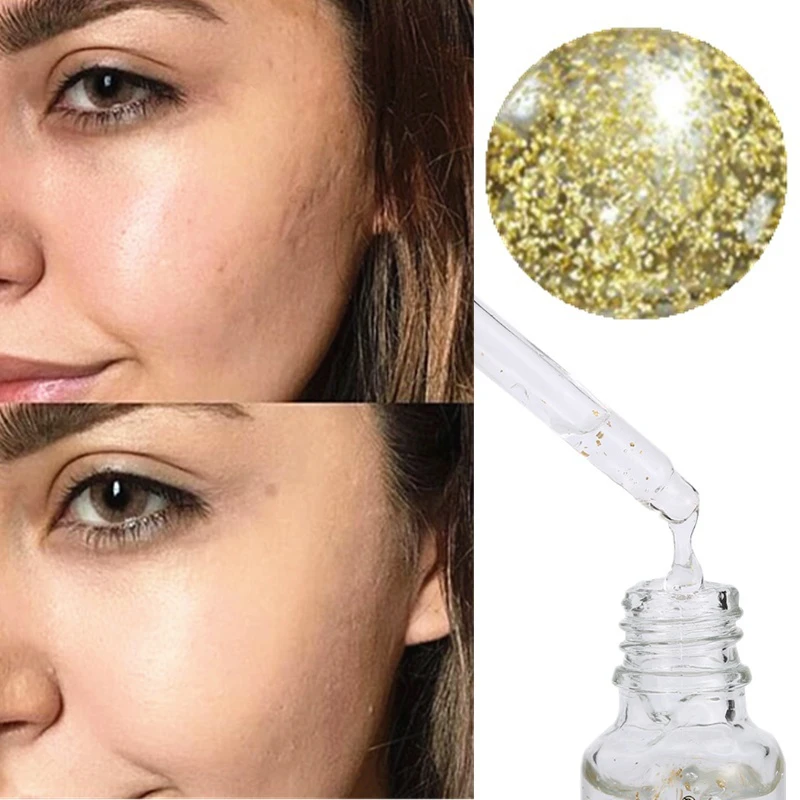 HTB1O3MZXcfrK1Rjy1Xdq6yemFXay