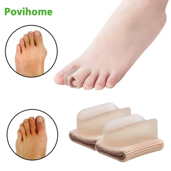 

Orthopedics Bunions Foot Care Pedicure Silicon Pad Protection Toe Spreader Hallux Valgus Feet care Tool Health Care 4Pcs Z24302
