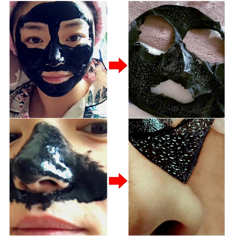 Средство для удаления угрей маска для носа уход за кожей дропшиппинг