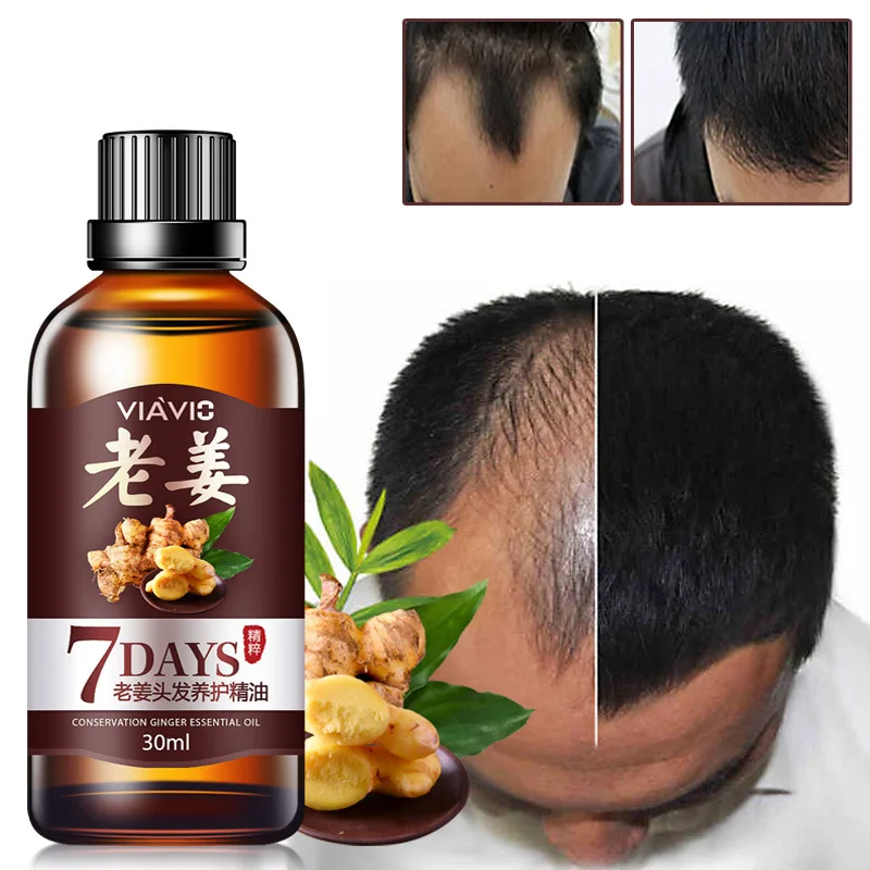 

30ml 7 day Fast Hair Growth Essential Oil Effective Hair Loss Treatment Regrowth Ginger Serum Hair Health Care Beauty