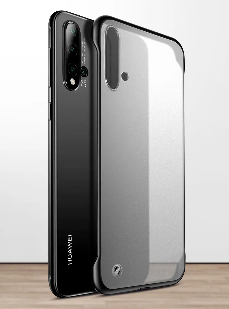 X1
