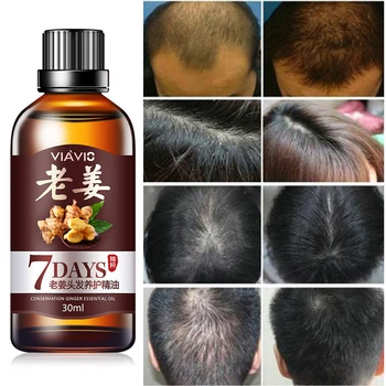 

Professional Men Women Hair Growth Hair Essential Oil Hair Care Oil Ginger Essence Hairdressing Dry Damaged Hair Nutrition TSLM1