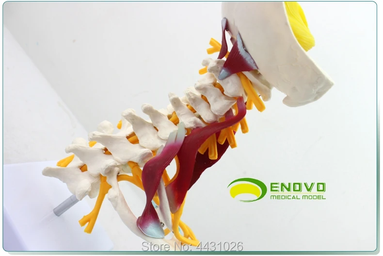 Модель человеческого костного образца в брахиальном сплетении мышечной модели шейного отдела позвоночника человека