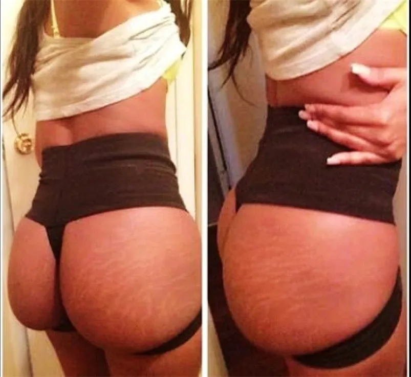 Sexy Bandage Butt Lifter Panties Bare Trainer Tummy Control Corset Waist Slim Body Shaper G String T Back Underpants Shapewear In Control Panties From Sexy Bandage Butt Lifter Panties Bare Trainer Tummy Control Corset Waist Slim Body Shaper G String T Back Underpants Shapewear In Control Panties From