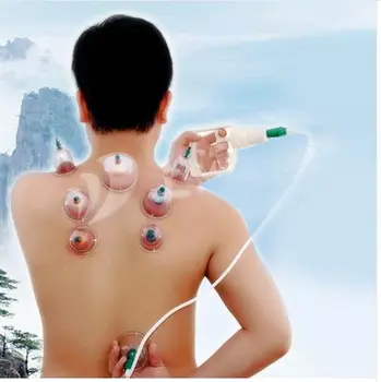 

Effective Healthy 24 Cups Medical Vacuum Cupping Suction Therapy Device Set Chinese Vacuum Cupping Massage Thick Therapy Sets