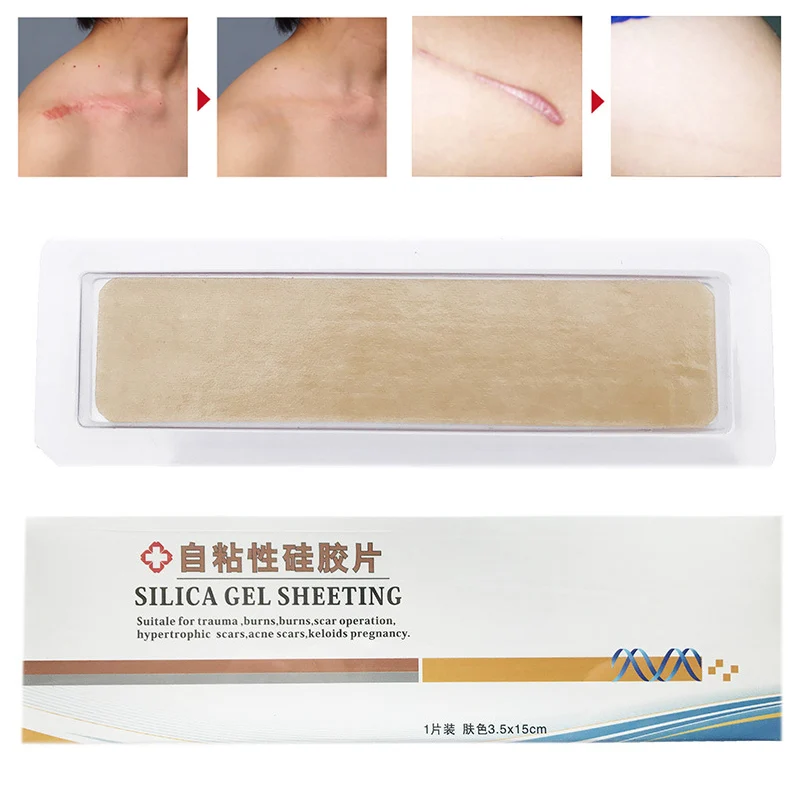 

2019 1 Pcs Silica Gel Sheeting Scar Removal Sheet Therapy Patch for Trauma Acne Pregnancy Scar DC88