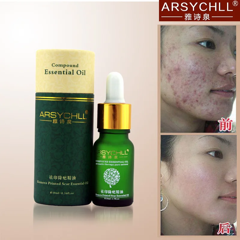 2015 Special Offer Maquiagens Face Care Scar Remov...