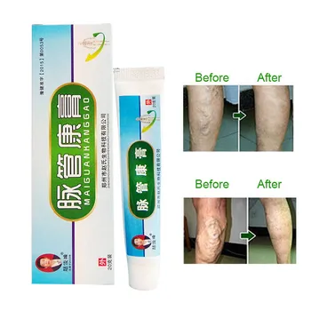 

Newly 20 g/box Natural Herbal Sophora Varicose Vein Massage for Treating Varicose Vascular