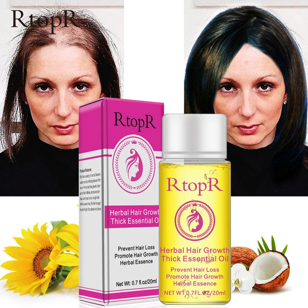 

Hot 2018 New Fashion 1PC Hair Growth Essence liquid Fast Hair Growth Natural Hair Loss Treatment Drop Shipping