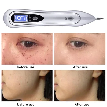

LCD Plasma Pen Face Skin care Dark Spot Remover Laser Mole Wart Removal Tattoo/Freckle Removal Tool Beauty Care