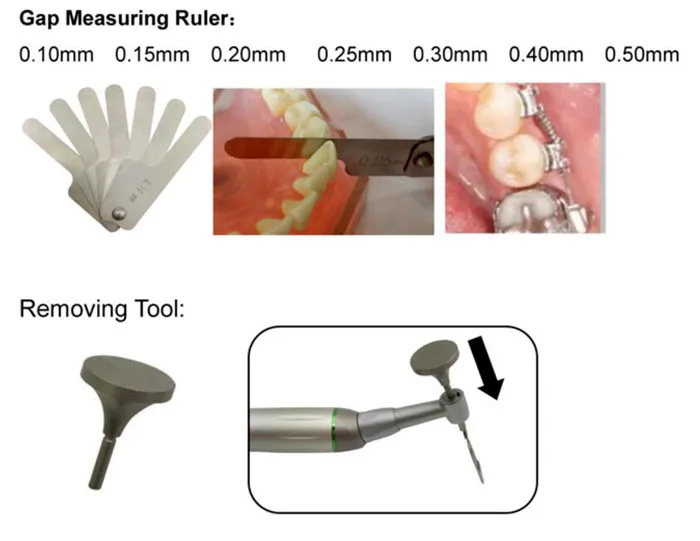 Reciprocating IPR System 05