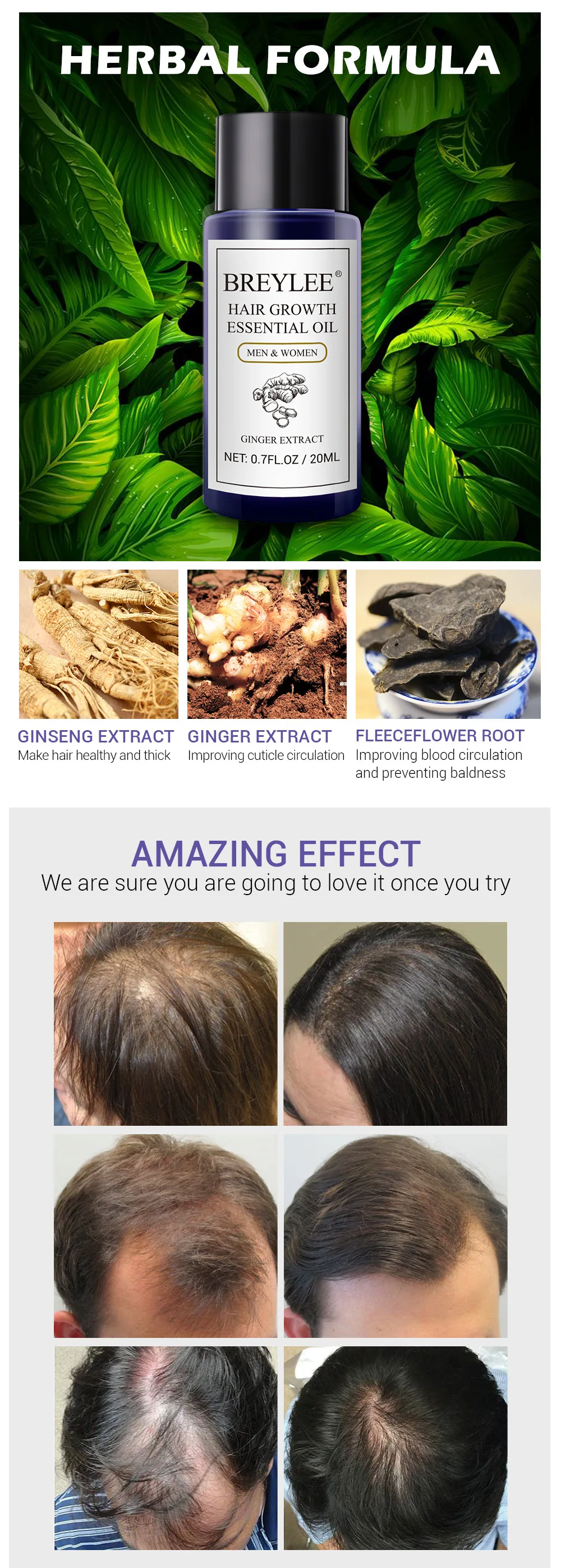 20 мл натуральное эфирное масло имбиря для роста волос жидкое масло для более быстрого роста волос мощное масло для лечения против выпадения волос продукты для ухода за волосами