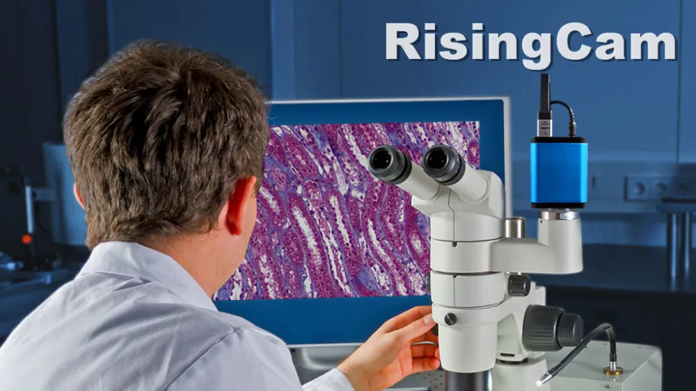 HD-Microscope-Camera-Applications_Clinical-Pathology1-1024x576