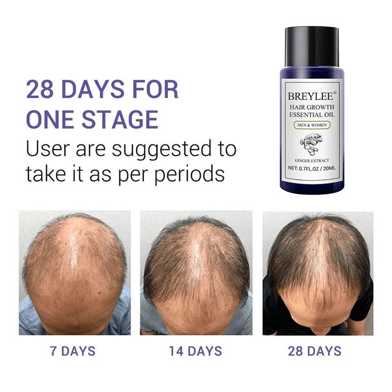 TYJR Hair Growth Essence Nourish Repair Hair Loss Treatment TYJR Hair Growth Essence Nourish Repair Hair Loss Treatment