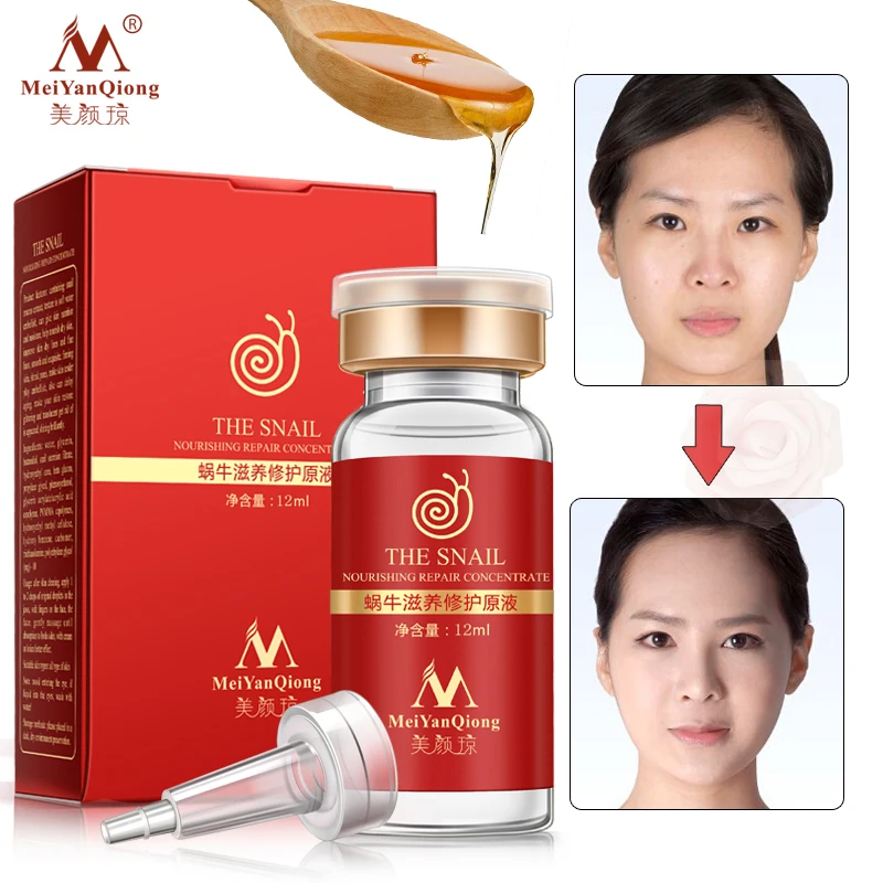 

MeiYanQiong Face serum for face Snail 100% Pure plant extracts pure hyaluronic acid whitening anti-acne Rejuvenation serum