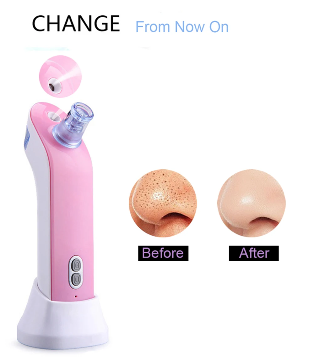 black head removal moisturising machine (4)