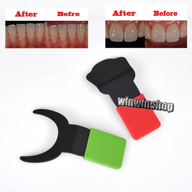 

2PCs Dental Contraster Dentist Orthodontic Endodontics Silicone Contraster Oral Black  Contrasters Dental Photography