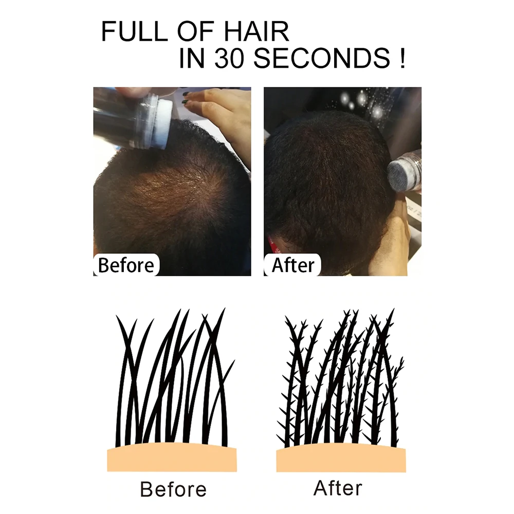 Sevich 12 г Кератиновое волокно для роста волос утолщенные продукты для выпадения волос наращивание густых волокон для роста волос TSLM1