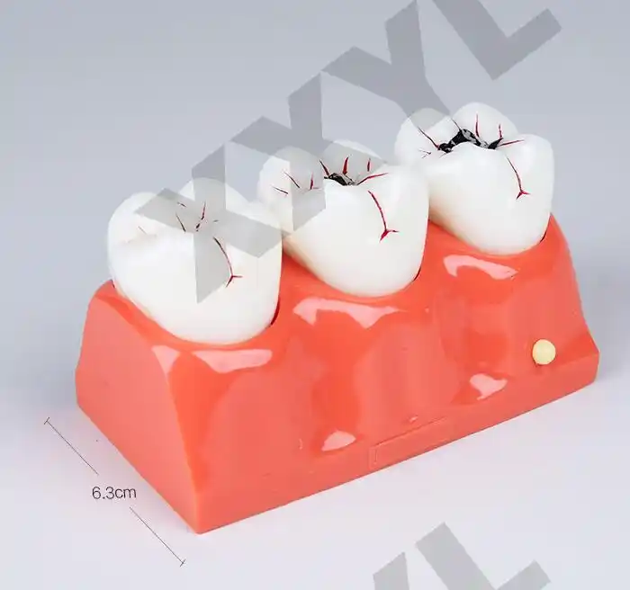 Dis Protez Malzemeleri Ve Fiyatlari Dentaladres