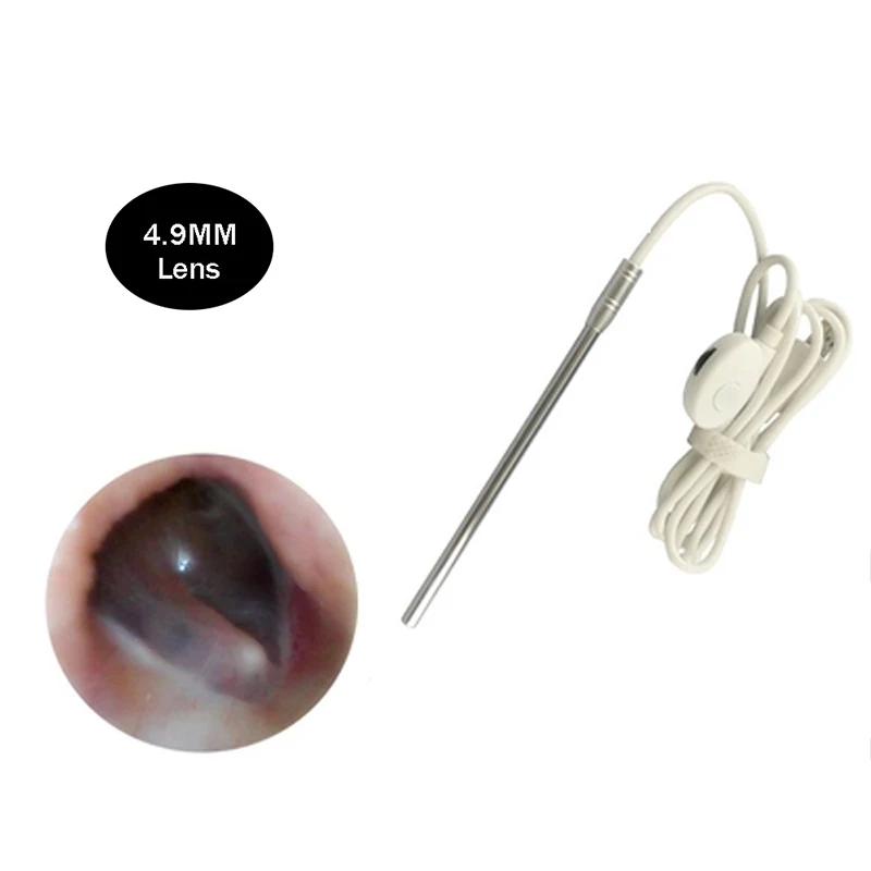 HD визуальная Ушная ложка, очиститель для ушей, эндоскоп с 4,9 мм линзой, инструмент для удаления воска ушей, многофункциональная барабанная перепонка, проверка здоровья, инструмент