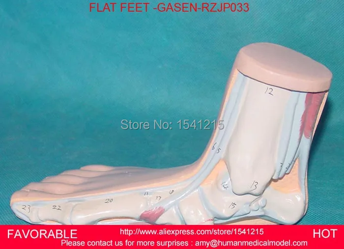 FLAT AND ARCHED FOOT,ANATOMY MODEL,ARCUATUS MODEL,HIGH ARCH FOOT MODEL, CLAW FOOT, ANATOMICAL FLAT FOOT-GASEN-RZJP033 FLAT AND ARCHED FOOT,ANATOMY MODEL,ARCUATUS MODEL,HIGH ARCH FOOT MODEL, CLAW FOOT, ANATOMICAL FLAT FOOT-GASEN-RZJP033