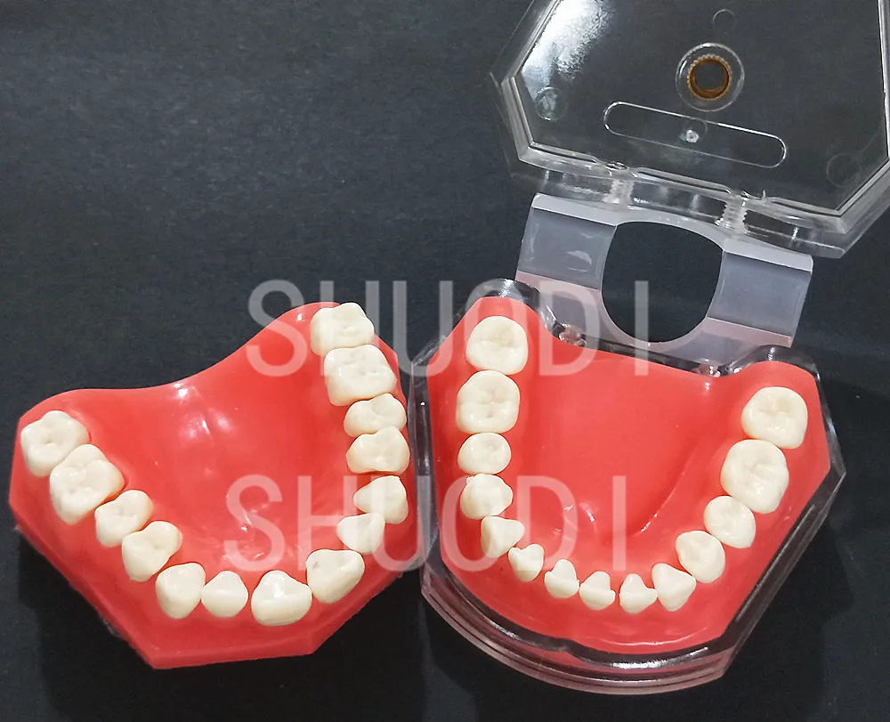 Koop Dental Studie Onderwijs Model Dental Standaard Model Removable Tanden VOLWASSEN Kinderen TYPODONT Model Tandarts Communicatie Model