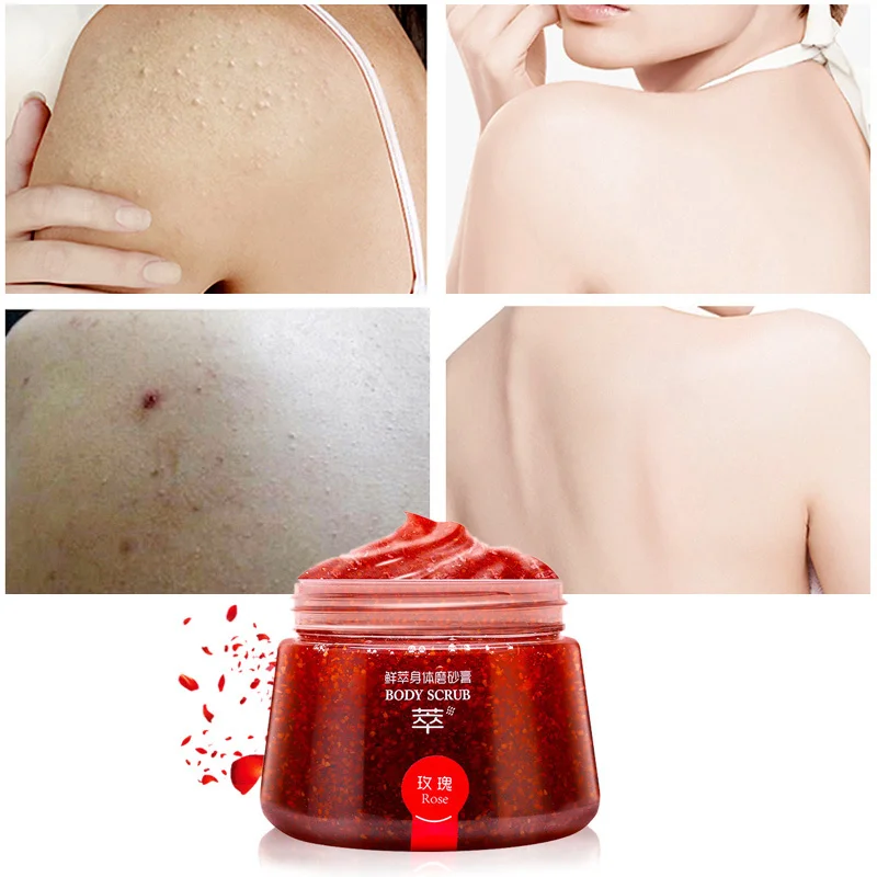 

MICAOJI Rose Moisturizing Body Cream Scrub Cream Natural face Exfoliator Remove acne Skin Care Brightening Plant Whitening 200g