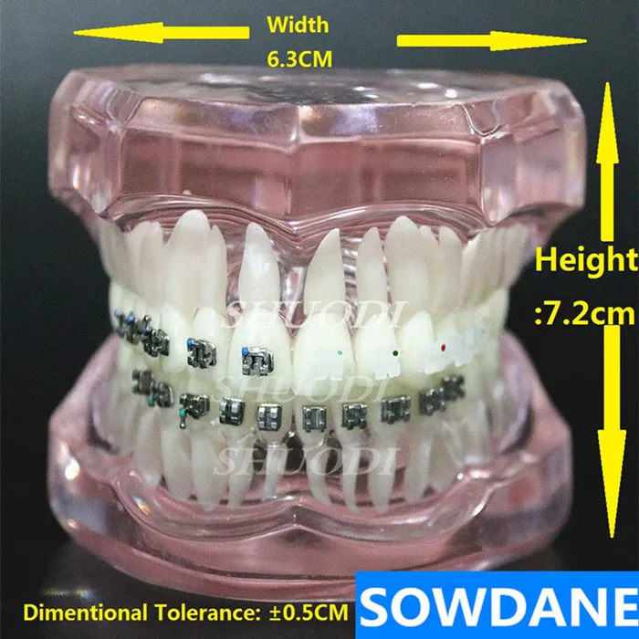Прозрачная Стоматологическая Ортодонтическая модель зубов с керамическими и металлическими кронштейнами для связи пациента - Цвет: Pink 4 comparison