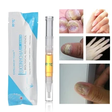1 шт. Полезная Лечение ногтей от грибка жидкая ручка яркий ногтей палец и ног ремонт Onychomycosis эссенция для удаления Уход за ногами инструмент