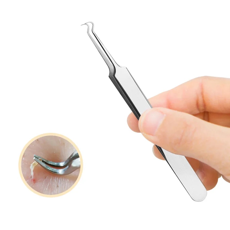 2018 New 1piece Acne Tweezers Black Head Pimples Removal Pointed Bend