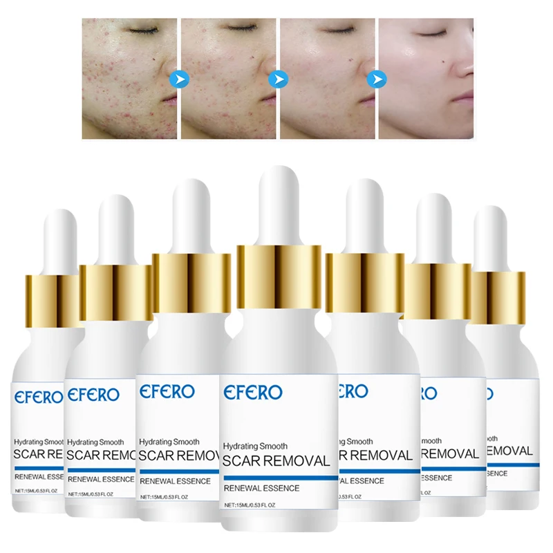 

3PCS Moisturizing Face Cream Spots Acne Blackhead Lighten Whitening Cream Smooth Firming Oil Control Face Skin Care