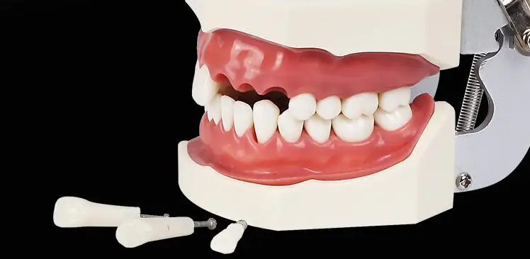 Peças de Reposição Aprendizagem Modelo Dentes Substituir Conjunto 28 Pcs - 32 Teeth Ensino 4 Cheap Clareamento dos dentes