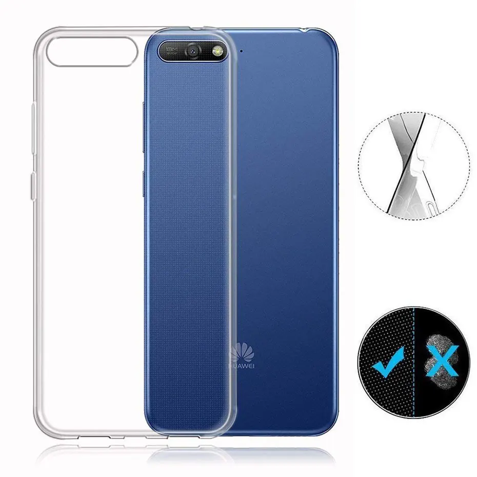X1