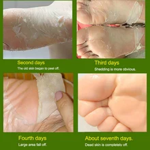 Ноги корки маска бамбуковая уксусная отшелушивающие носки Baby Care педикюр носки удалить мертвые кутикулы кожи для педикюрный инструмент для удаления мозолей