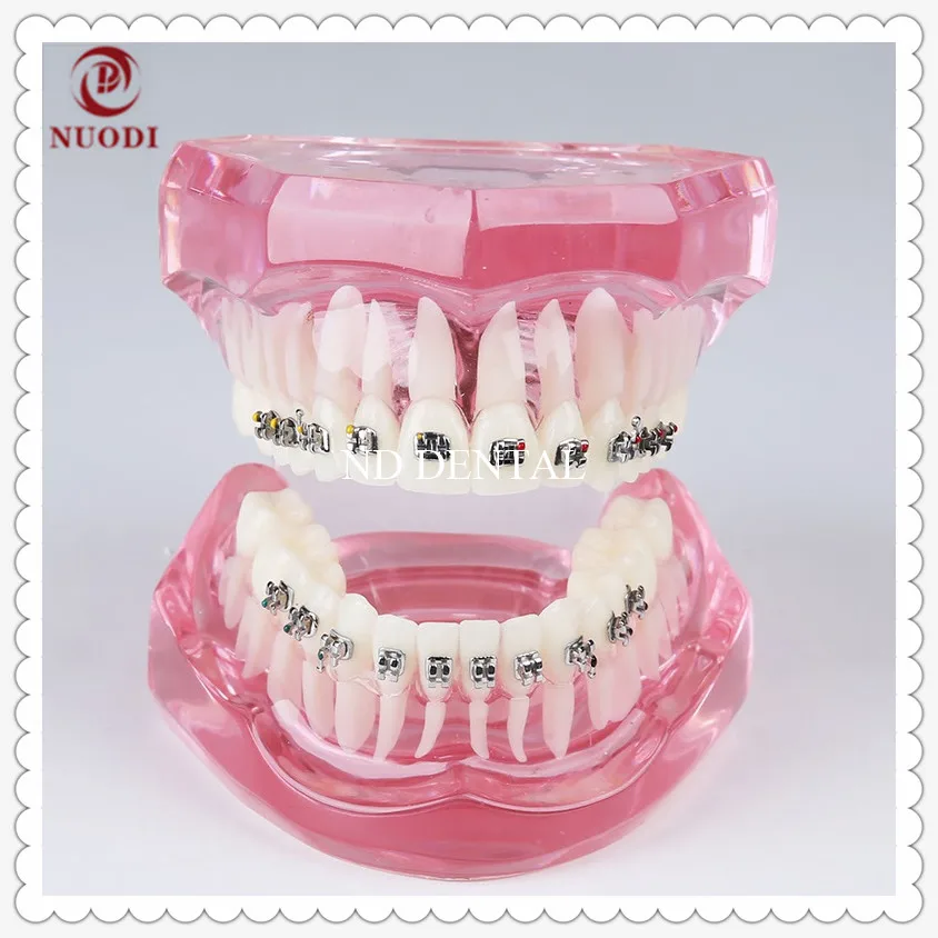 

Orthodontic teeth Model with Metal bracket/Education Teeth model M3001/Orthodontic practice model/Pink transparent tooth model