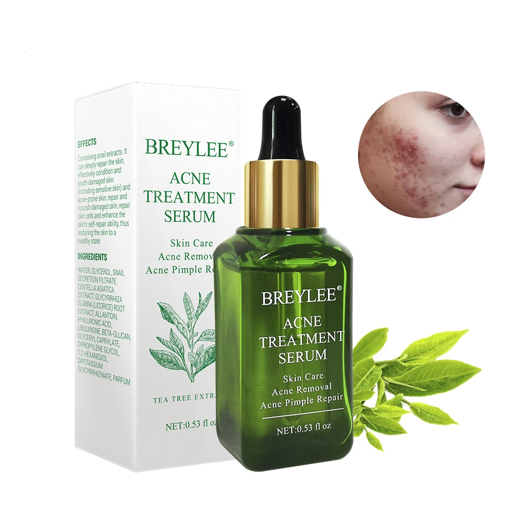 15ml Acne Treatment Serum Facial Essence Anti Acne Scar Removal Cream
