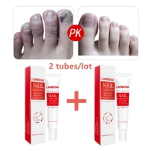 2 шт. LANBENA ремонт ногтей гель Лечение ногтей от грибка Сыворотка для удаления онихомикоз носком ногтей питательный ремонт ручной и уход за ногтями на ногах