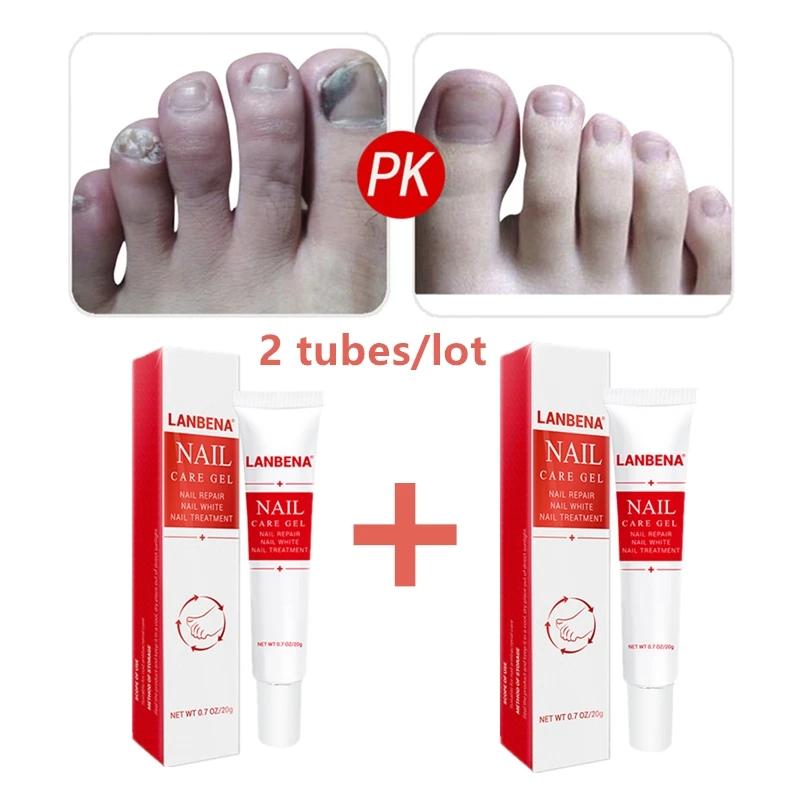 2pcs LANBENA Nail Repair Gel Fungal Nail Treatment Serum Remove