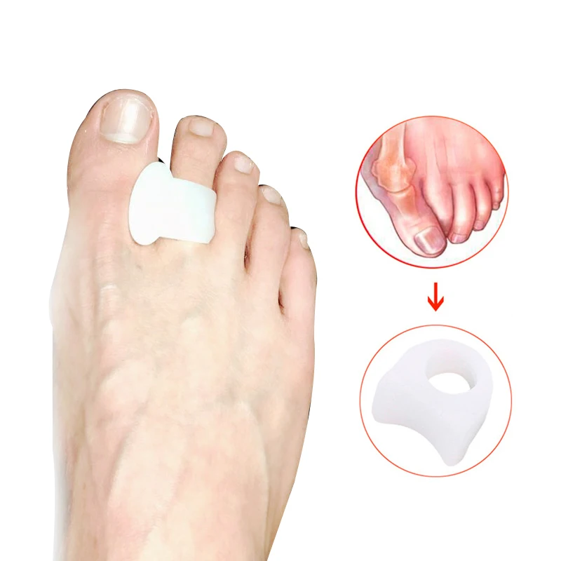 1Pair Braces Foot Care Toe Braces Silicone Toe Separator Hallux Valgus Orthopedic Corrector Pedicure Tools Health Care Products