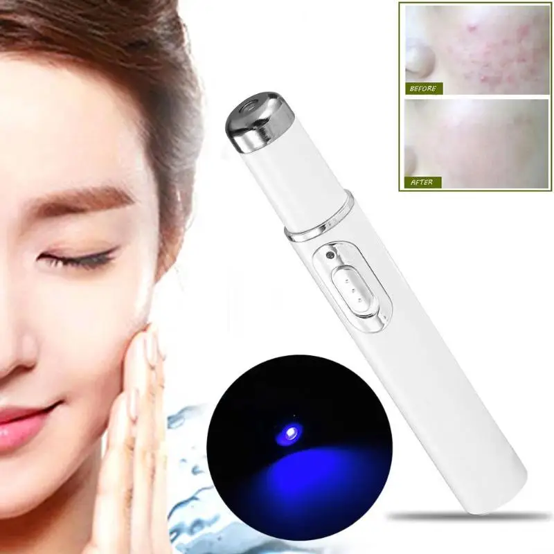 Portable Acne Laser Pen 415nm Blue Light Therapy Acne Laser Pen Scar Wrinkle Removal Beauty