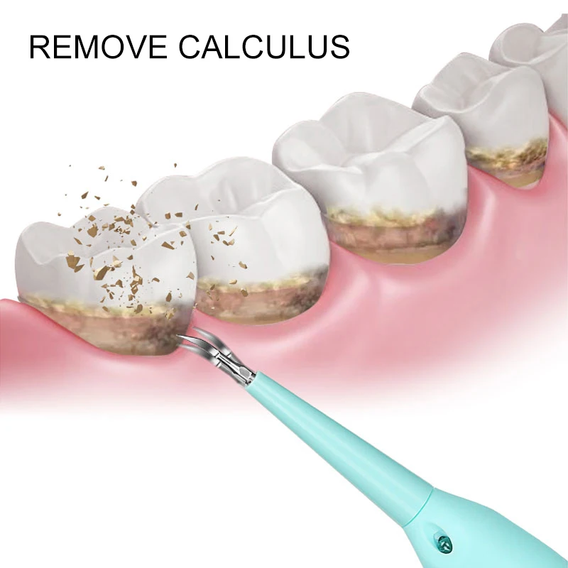 Новое поколение портативная электрическая звуковая зубная скалер для удаления зубов, удаление пятна на зубах приспособление для Тартара, отбеливание гигиены полости рта