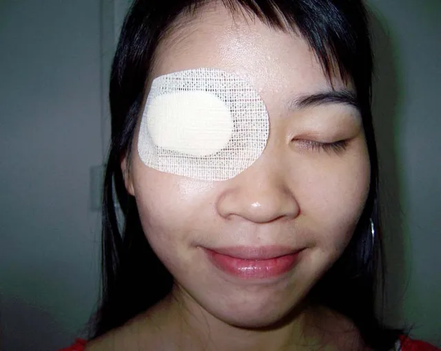 10pcs Sterile eye patch Medical non woven eye patch eyeshade eye pad