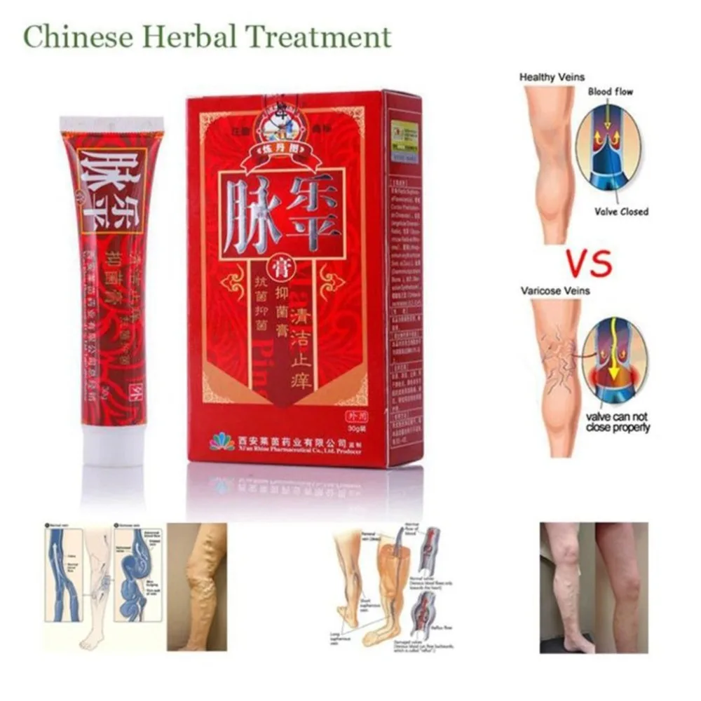 

Massage Medicine Herbal Ointment Varicose Veins Vasculitis Treatment Foot Care Cream Relief Swelling Pain External Use Cream